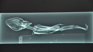 Atacama Humanoid~Skull is not result of artificial deformation